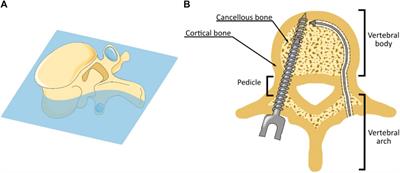 Tsetse fly inspired steerable bone drill—a proof of concept
